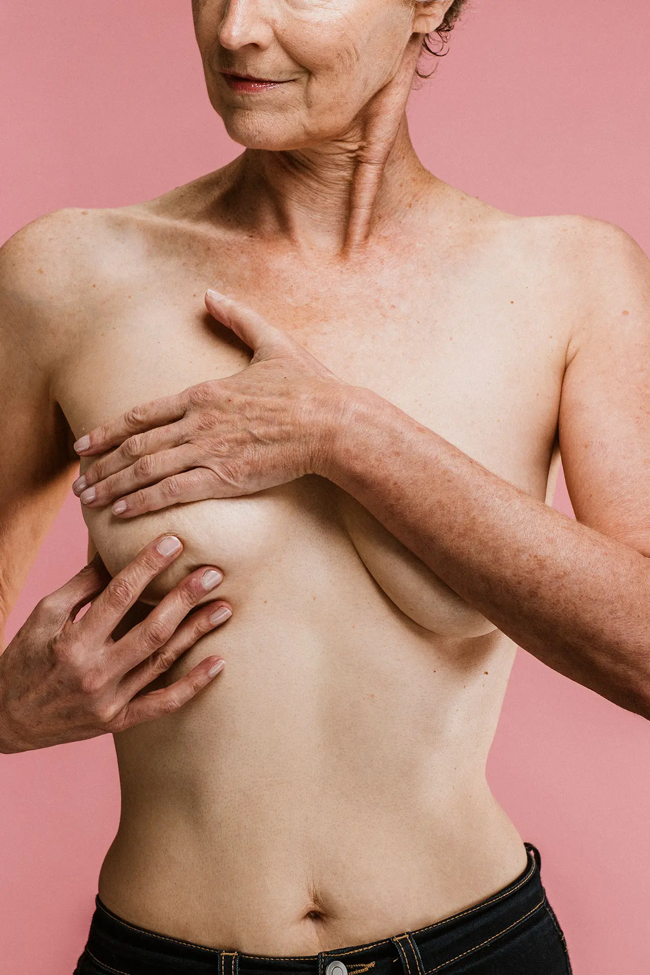 Définition reconstruction mammaire - CEBC