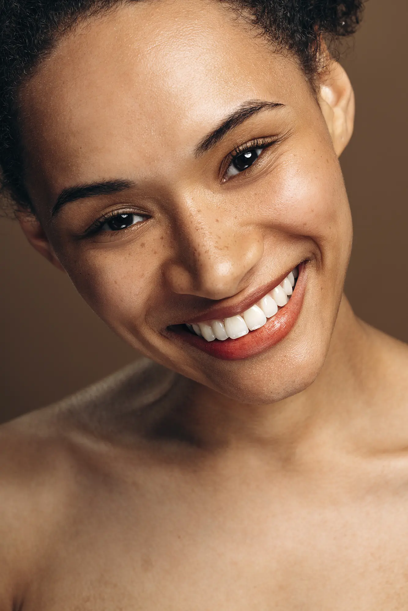 Définition du lifting lèvre supérieur | Lip lift | CEBC Bordeaux