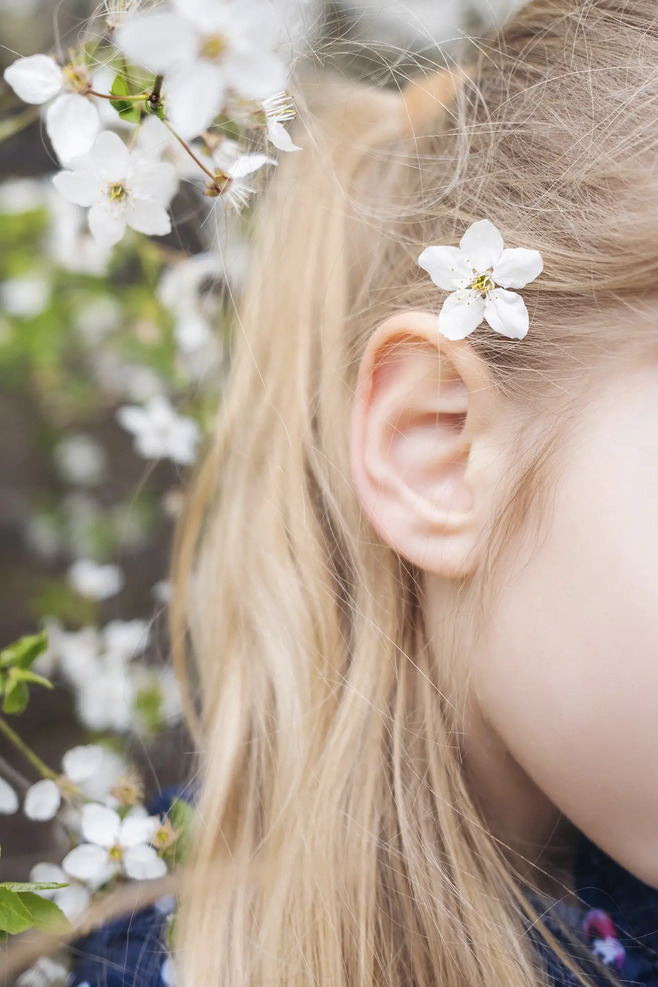 Définition otoplastie | Oreilles décollées | CEBC Bordeaux