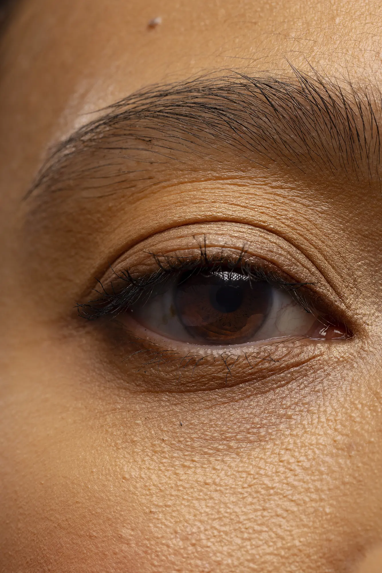 Définition des paupières | Blépharoplastie | CEBC à Bordeaux