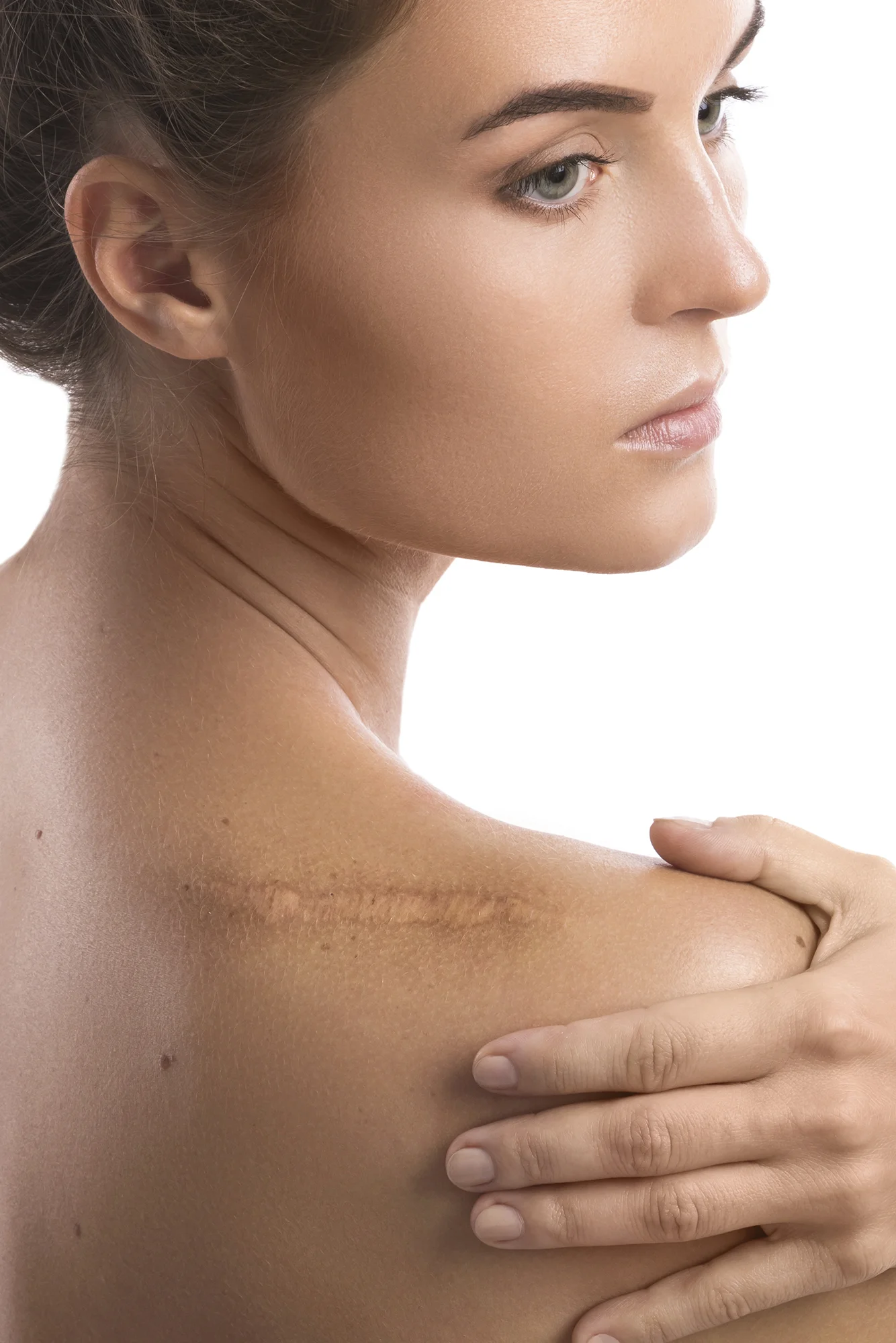 Définition atténuer une cicatrice - CEBC